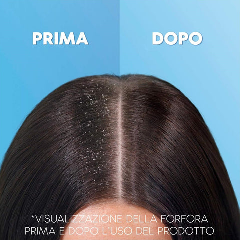 shampoo antiforfora Head & Shoulders Classic Clean bottiglia ricaricabile in alluminio 430 ml
